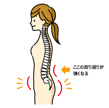 なぜ、出っ尻、お腹ぽっこりになるの?